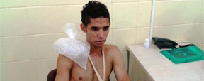 Lateral Renato sofre luxação no ombro e pode passar por cirurgia (Sport/Site Oficial)